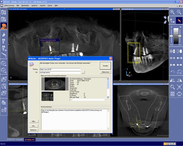 Integration des MPMailer DirectDental Plugins in die SIRONA SIDEXIS Anwendung. Mit dem MPMailer Plugin können auch 3D GALILEOS Untersuchungsdaten in einer sicheren Teleradiologieumgebung übertragen und kommuniziert werden. Ein MICROPACS Produkt.